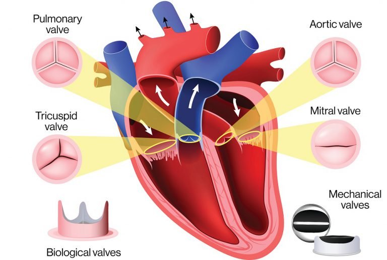 what-are-the-different-options-for-heart-valve-replacement-surgery